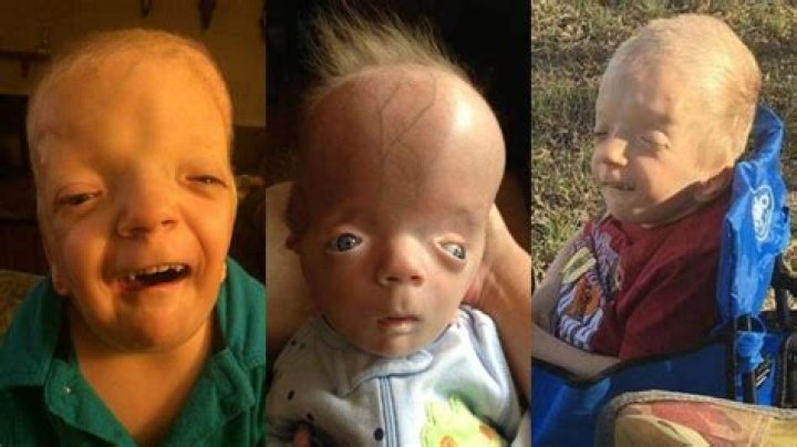 6 Kids Who Are Born With Incredibly Rare And Unusual Looks!