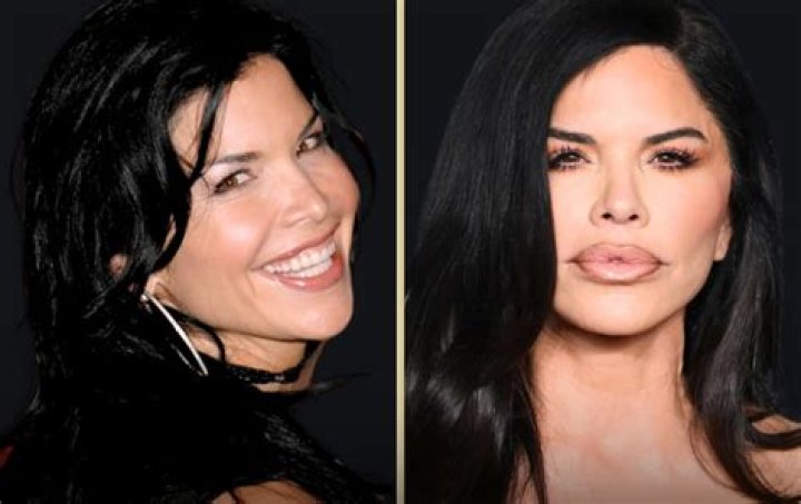 A Close Look At Miranda Cosgrove's Plastic Surgery Details