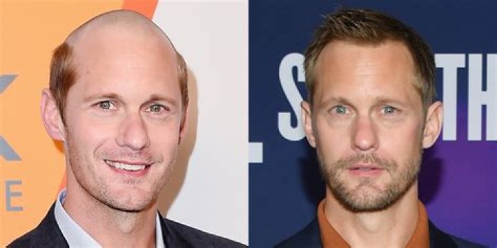 Alexander Skarsgard shaved off half of his hair for a movie: love it or hate it?