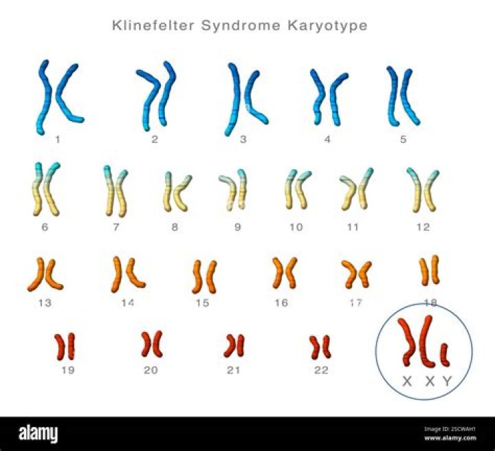 Are down and Klinefelter syndromes chromosomal abnormalities?