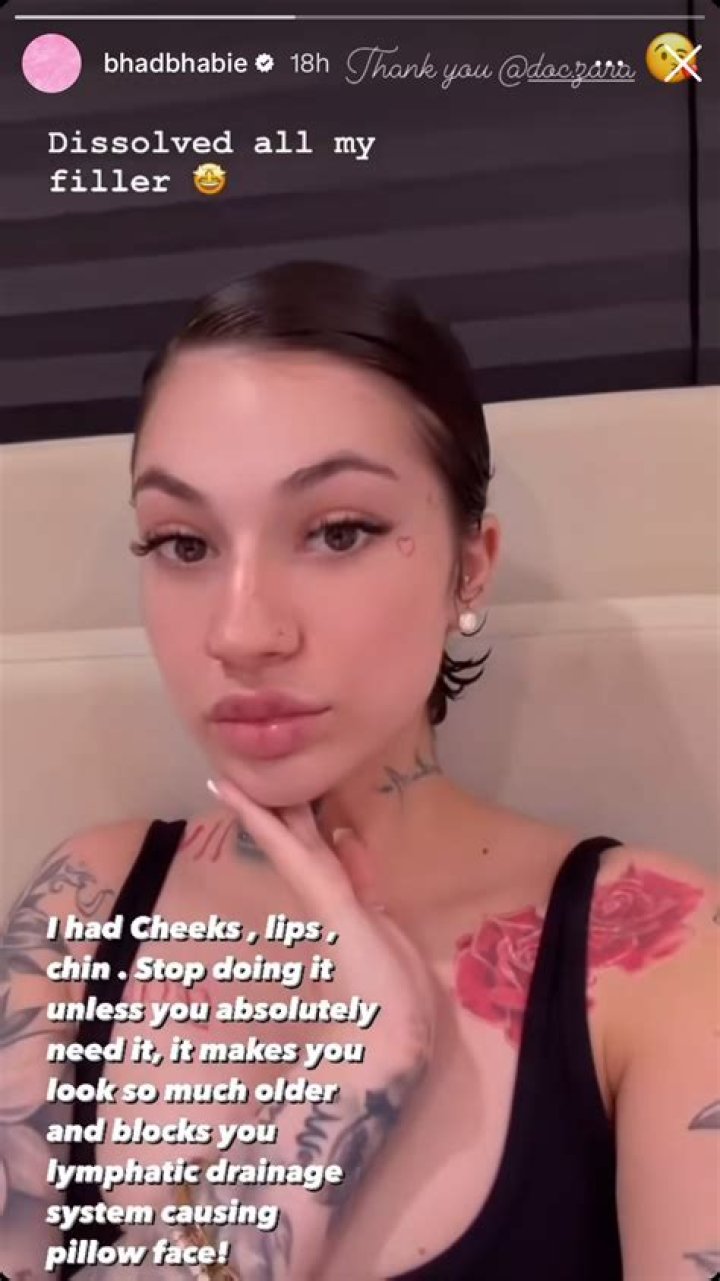 Bhad Bhabie dissolved her fillers: ‘It makes you look older & blocks your lymphatic system’
