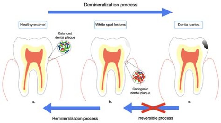 Can enamel be used on induction?