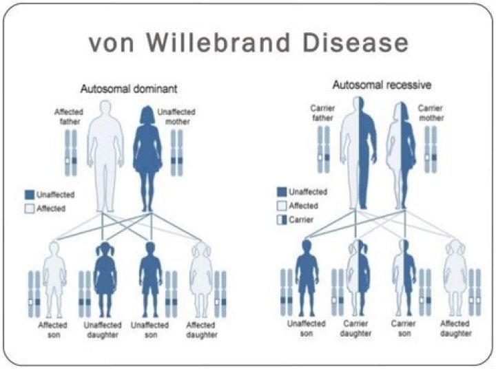 Can you die from von Willebrand disease?