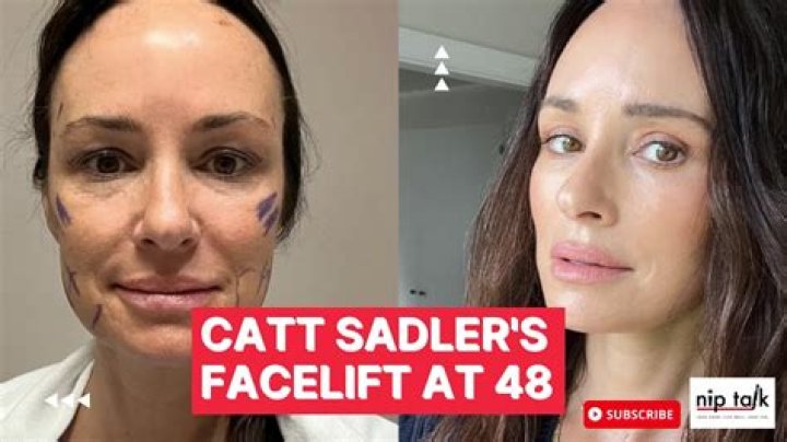 Catt Sadler, 48, got a facelift, calls it ‘a step into my own power’