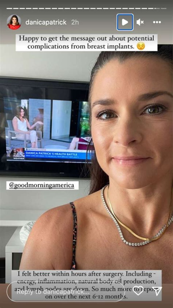 Danica Patrick had breast implant illness: ‘trust your intuition, get them removed’