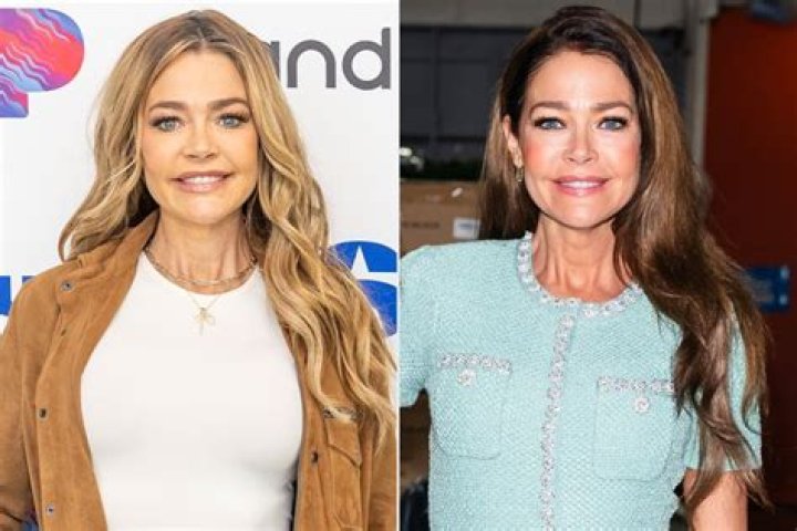 Denise Richards shares video of non-invasive facial, has denied Botox and fillers