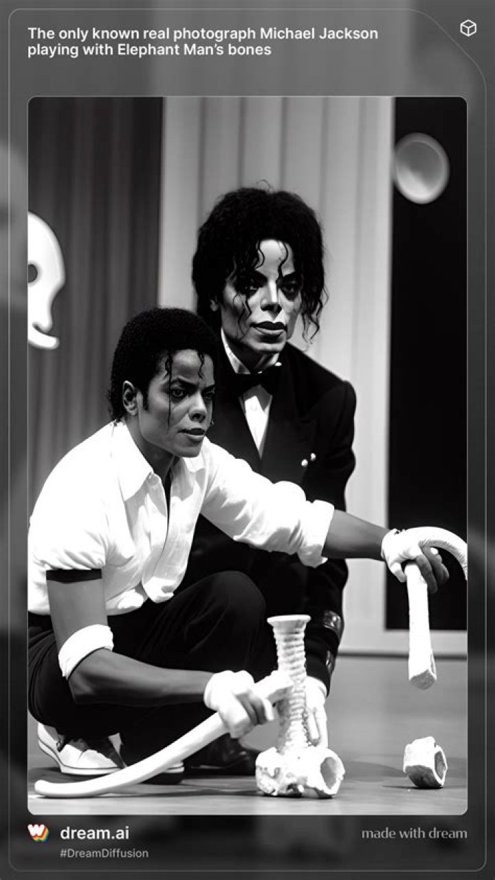 Did Michael Jackson buy the Elephant Man’s bones?