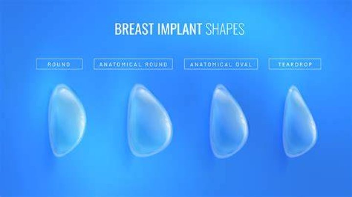 Heidi Montag’s F-cup implants almost ‘bottomed-out’ & fell to her belly button