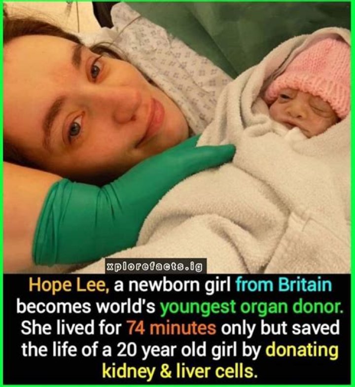 Hope Lee, A Baby Who Died After 1 Hour Of Birth Crowned As A Youngest Organ Donor!