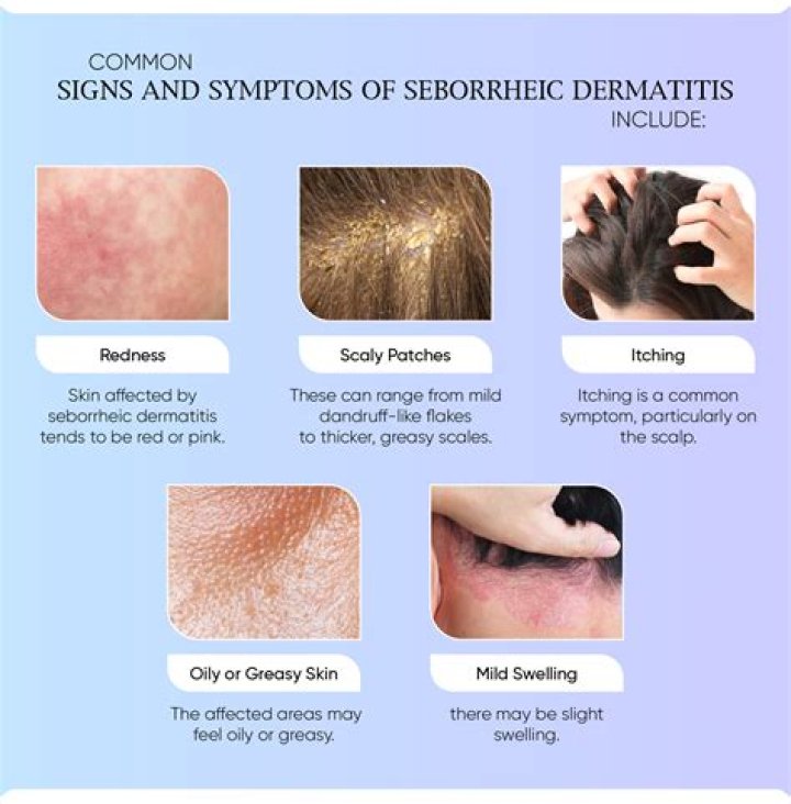 How do you pronounce the word seborrheic keratosis?