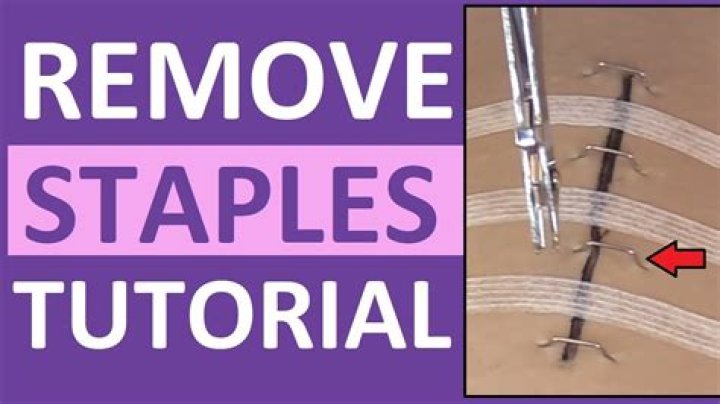 How do you remove staples from fabric?