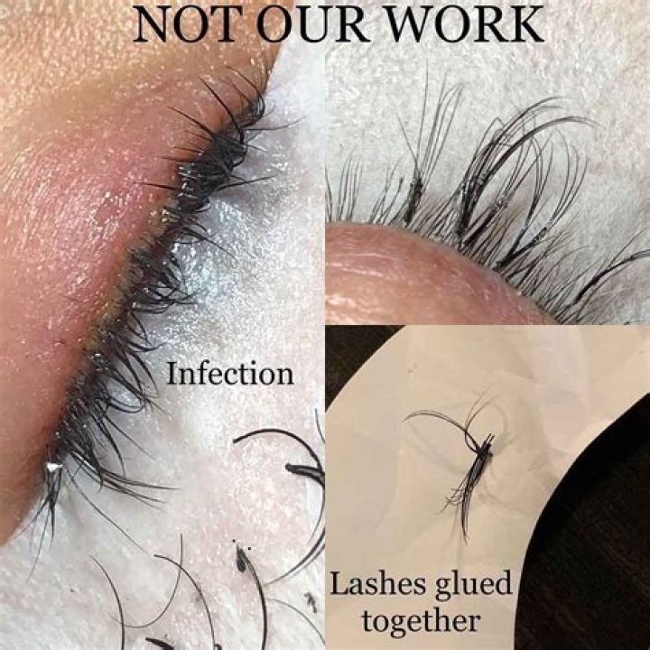 Is it normal for your eyes to be red after eyelash extensions?