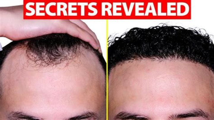 Jude Law is finally owning his receding hairline/baldness: sexy or busted?