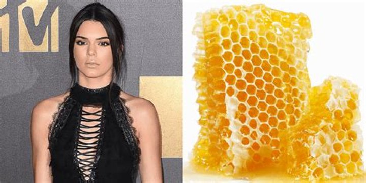 Kendall Jenner has trypophobia, a fear of small holes in weird patterns