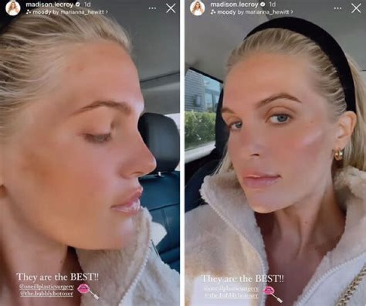 Madison Lecroy shows off her body post plastic surgery aiming self-confidence and body positivity!