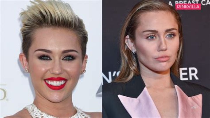 Miley Cyrus has a nodule on her vocal cord