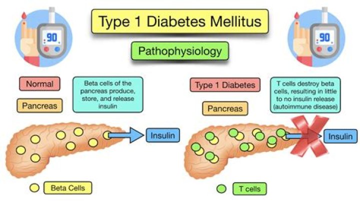 Model Lila Moss is suffering from Type 1 Diabetes!