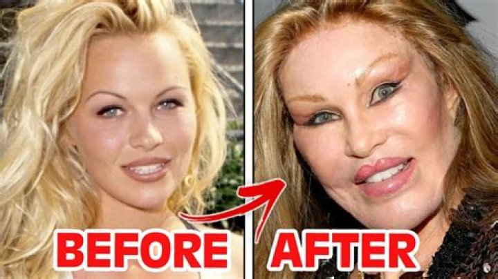 Priscilla Presley’s face is the result of a plastic surgery scam artist