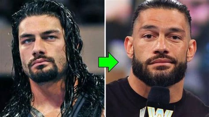 Roman Reigns plastic surgery: Roman Reigns Before and After Photos