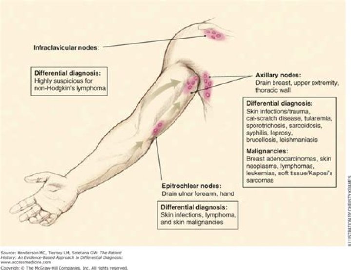 What causes swollen Epitrochlear lymph nodes?