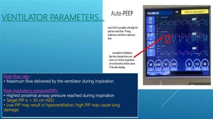 What does Pip mean on a ventilator?