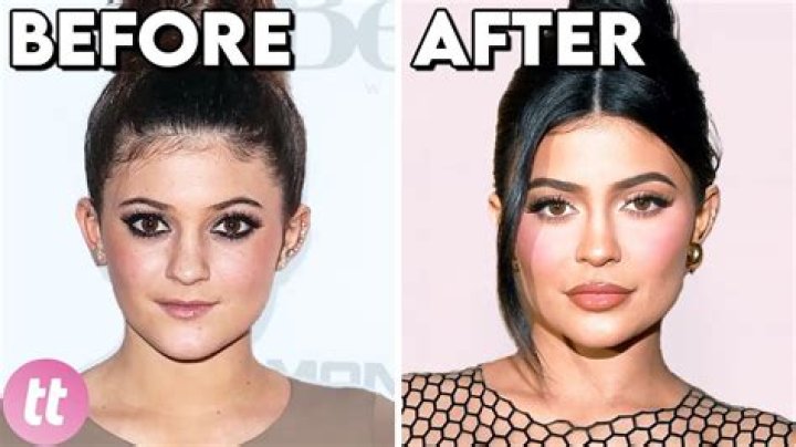 What Happened To Amruta Fadnavis Face? Plastic Surgery Before And After