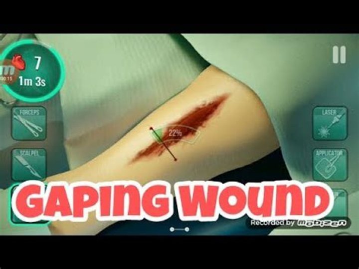 What is a gaping wound?