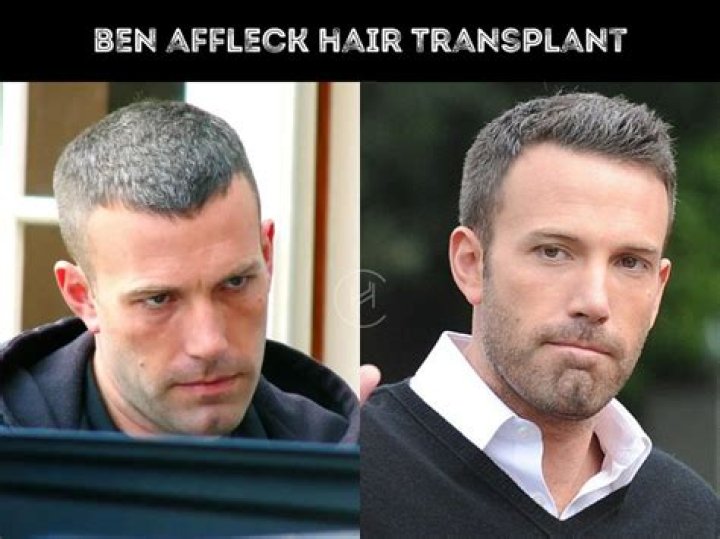 What’s going on with Ben Affleck’s hair?