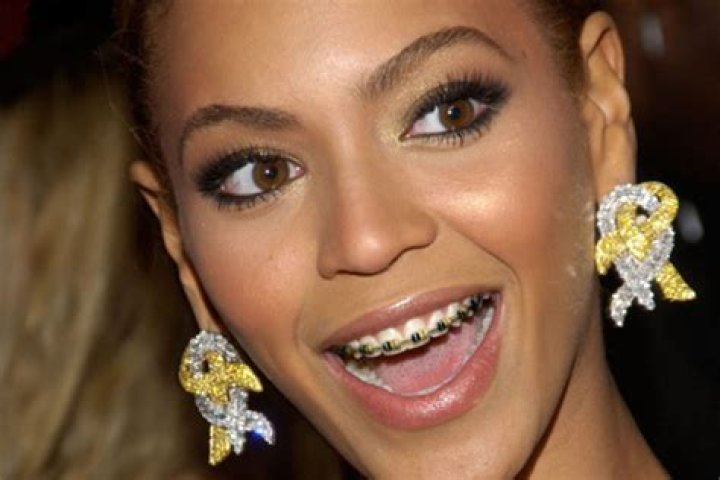 When did Gwen Stefani get braces?
